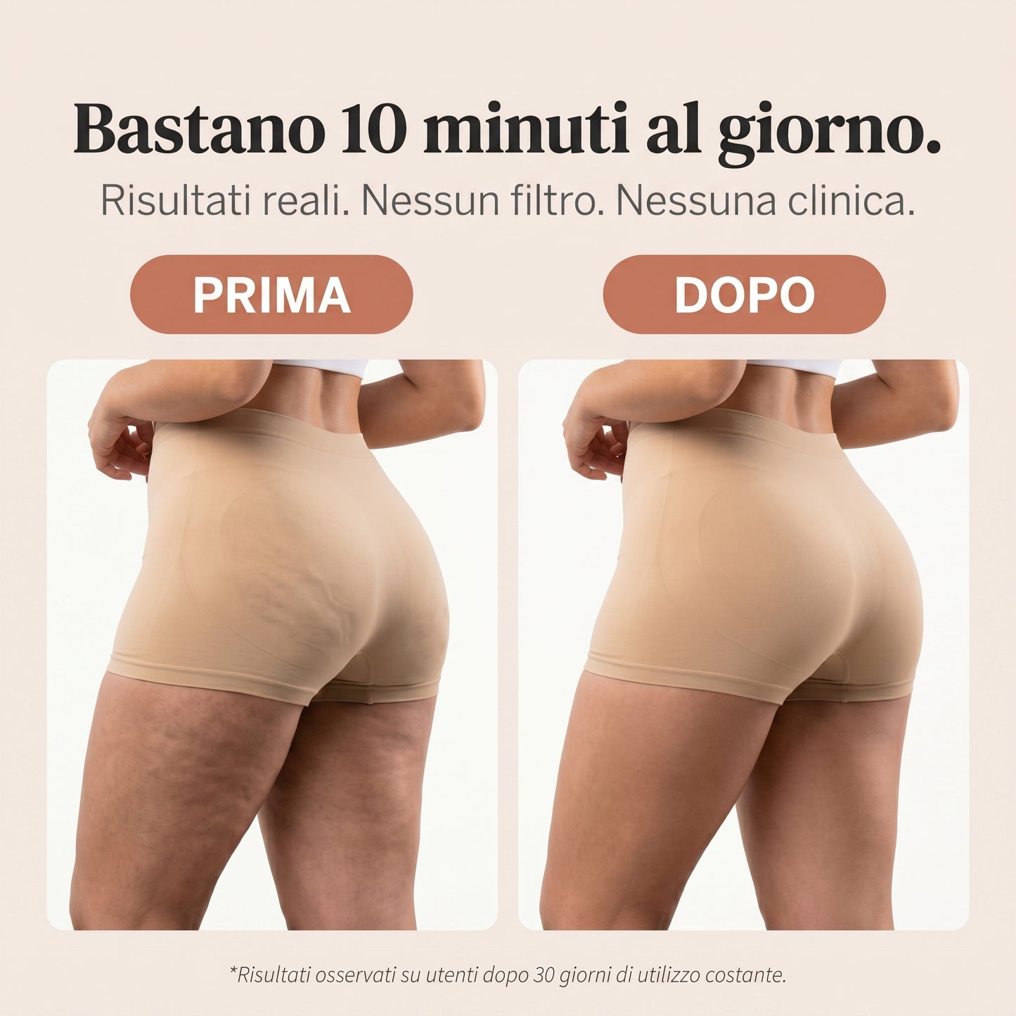 Riduci visibilmente la cellulite a casa