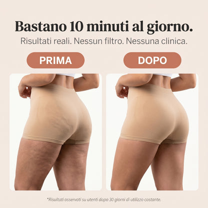 Riduci visibilmente la cellulite a casa